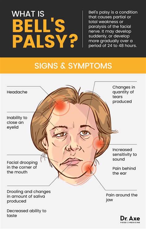bell's palsy symptoms and causes